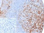 CD54/ICAM-1 Antibody in Immunohistochemistry (Paraffin) (IHC (P))