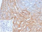 CD54/ICAM-1 Antibody in Immunohistochemistry (Paraffin) (IHC (P))