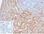 CD54/ICAM-1 Antibody in Immunohistochemistry (Paraffin) (IHC (P))