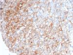 CD54/ICAM-1 Antibody in Immunohistochemistry (Paraffin) (IHC (P))