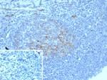 CD54/ICAM-1 Antibody in Immunohistochemistry (Paraffin) (IHC (P))