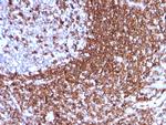 CD50/ICAM3 Antibody in Immunohistochemistry (Paraffin) (IHC (P))