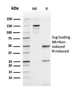 CD50/ICAM3 Antibody in SDS-PAGE (SDS-PAGE)