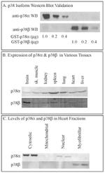 p38 MAPK beta Antibody in Western Blot (WB)