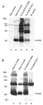 Connexin 36 Antibody in Immunoprecipitation (IP)