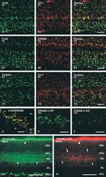 ZO-2 Antibody in Immunohistochemistry (IHC)