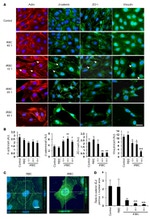 Vinculin Antibody in Immunocytochemistry (ICC/IF)