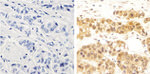 NFkB p65 Antibody in Immunohistochemistry (Paraffin) (IHC (P))