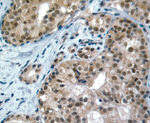 c-Kit Antibody in Immunohistochemistry (IHC)