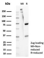 STING1/TMEM173 Antibody in SDS-PAGE (SDS-PAGE)