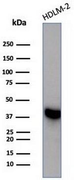 STING1/TMEM173 Antibody in Western Blot (WB)