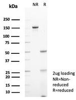 STING1/TMEM173 Antibody in SDS-PAGE (SDS-PAGE)