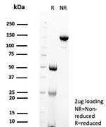 STING1/TMEM173 Antibody in SDS-PAGE (SDS-PAGE)