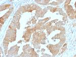 IDH1 (Isocitrate Dehydrogenase) Antibody in Immunohistochemistry (Paraffin) (IHC (P))