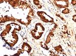 IDH1-R132H (Isocitrate Dehydrogenase) Antibody in Immunohistochemistry (Paraffin) (IHC (P))