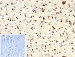 IDH1-R132H (Isocitrate Dehydrogenase) Antibody in Immunohistochemistry (Paraffin) (IHC (P))