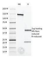 Interferon alpha-1 (IFNA1) Antibody in SDS-PAGE (SDS-PAGE)