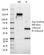 Interferon alpha-2 (IFNA2) Antibody in SDS-PAGE (SDS-PAGE)