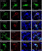 Connexin 43 Antibody in Immunohistochemistry (IHC)