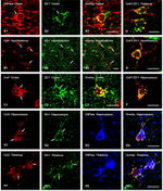 Connexin 43 Antibody in Immunohistochemistry (IHC)