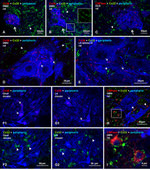 Connexin 32 Antibody in Immunohistochemistry (IHC)