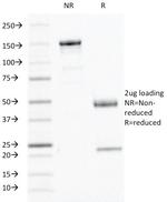 Interferon gamma (IFNG) Antibody in SDS-PAGE (SDS-PAGE)