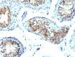 Interferon gamma (IFNG) Antibody in Immunohistochemistry (Paraffin) (IHC (P))