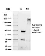 Interferon gamma (IFNG) Antibody in SDS-PAGE (SDS-PAGE)