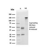 Apolipoprotein D/APO-D Antibody in SDS-PAGE (SDS-PAGE)