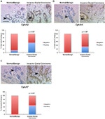 EphA2 Antibody in Immunohistochemistry (IHC)