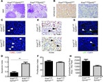 EphA2 Antibody in Immunohistochemistry (IHC)