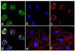 EphA2 Antibody in Immunocytochemistry (ICC/IF)