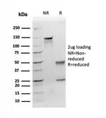 Apolipoprotein E/APOE Antibody in Immunoelectrophoresis (IE)