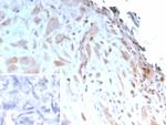 IGFBP3 Antibody in Immunohistochemistry (Paraffin) (IHC (P))