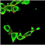 IGFBP3 Antibody in Immunocytochemistry (ICC/IF)