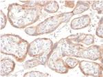 IGFBP3 Antibody in Immunohistochemistry (Paraffin) (IHC (P))