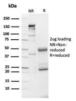 IGFBP3 Antibody in Immunoelectrophoresis (IE)