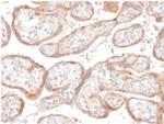 IGFBP3 Antibody in Immunohistochemistry (Paraffin) (IHC (P))