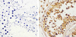 c-Kit Antibody in Immunohistochemistry (Paraffin) (IHC (P))