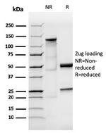 IgA (Immunoglobulin Alpha Heavy Chain) (B-Cell Marker) Antibody in SDS-PAGE (SDS-PAGE)