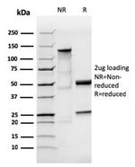 IgA (Immunoglobulin Alpha Heavy Chain) (B-Cell Marker) Antibody in Immunoelectrophoresis (IE)