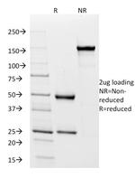 IgD (Immunoglobulin Delta Heavy Chain) (B-Cell Marker) Antibody in SDS-PAGE (SDS-PAGE)