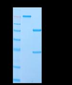 IgD (Immunoglobulin Delta Heavy Chain) (B-Cell Marker) Antibody in SDS-PAGE (SDS-PAGE)