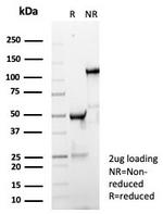 IgD (Immunoglobulin Delta Heavy Chain) (B-Cell Marker) Antibody in SDS-PAGE (SDS-PAGE)