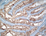 MUC4 Antibody in Immunohistochemistry (IHC)