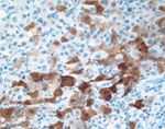 NY-ESO-1 Antibody in Immunohistochemistry (IHC)