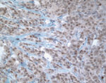 MGMT Antibody in Immunohistochemistry (IHC)