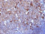 IgG (Immunoglobulin Gamma Heavy Chain) (B-Cell Marker) Antibody in Immunohistochemistry (Paraffin) (IHC (P))