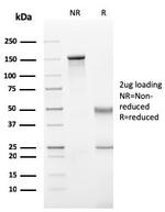 IgG (Immunoglobulin Gamma Heavy Chain) Antibody in SDS-PAGE (SDS-PAGE)