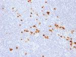 IgG (Immunoglobulin Gamma Heavy Chain) (IGHG) Antibody in Immunohistochemistry (Paraffin) (IHC (P))